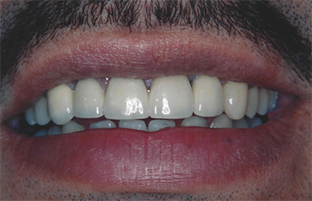 Salisbury restorative dentistry